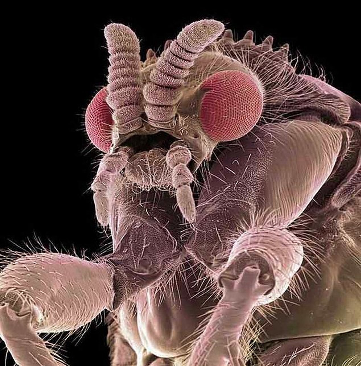 Бактерии на мухе. Мокрец мошка под микроскопом. Северная мошка под микроскопом. Зубы мошкары под микроскопом. Астраханская мошка под микроскопом.