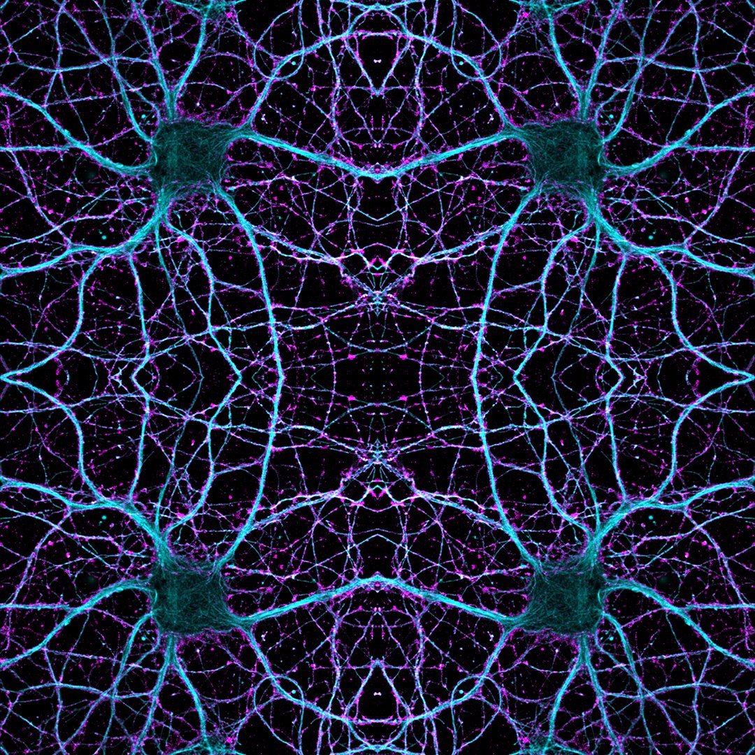 Нейросеть генерирует картинки. Нейронные микросети. Нейронные сети Алиса. Мозг нейросеть. Нейронные связи в мозге.
