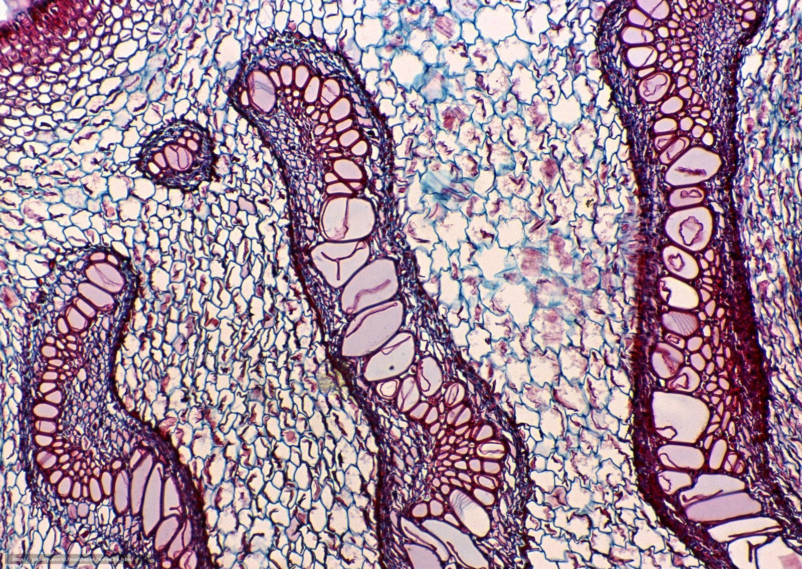 Какую клетку можно увидеть. Металлокониозы гистология. Микрофотография гистология микроскоп. Микрофотографии гистология. Биологический микроскоп Bestscope.