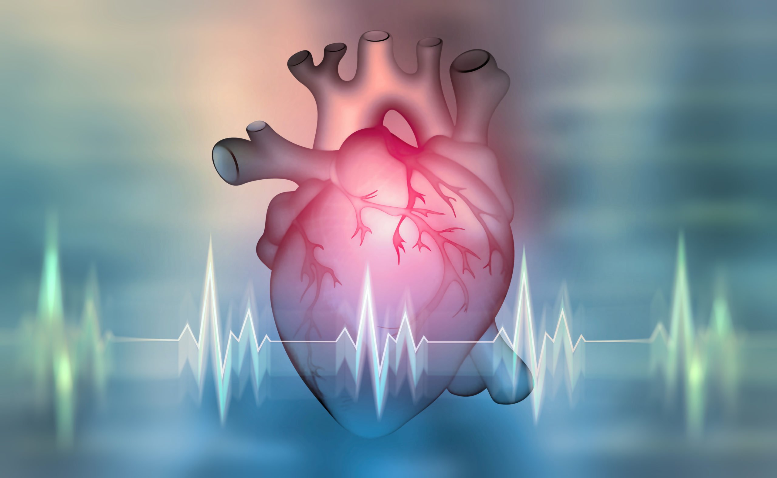 Донорство сердца. Сердце насос. Трансплантация сердца. Рисунок трансплантологии сердца.