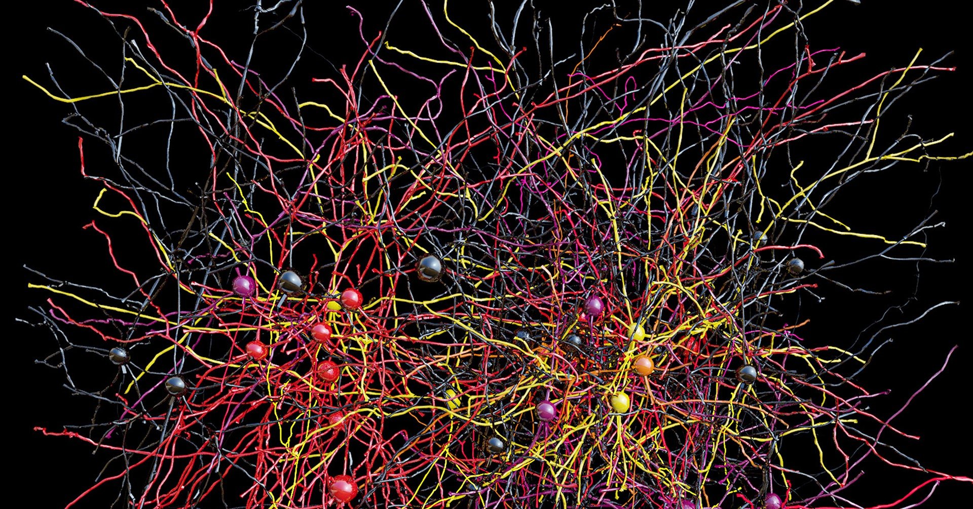 Как называются клетки головного мозга. Нейросеть синапс. Нейрон Пуанкаре микрофотография. Нейронная сеть мозга. Нейрон в нейронной сети.