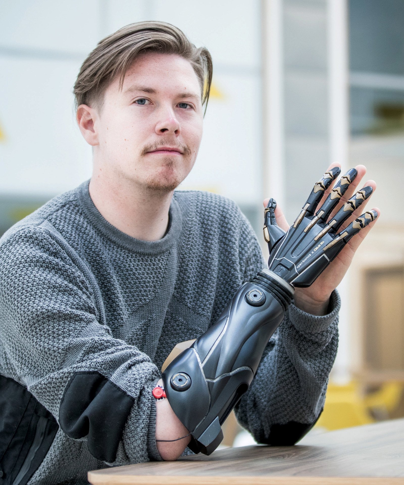 Наиболее продвинутый. Моторика бионические протезы. Джесси Салливан бионические протезы.